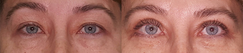 eyes06